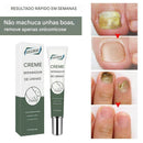 Creme Antifúngico para Unhas Eelhoe – Restaura e Fortalece