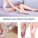 Removedor de Calos Elétrico - Brilho Shop