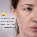 Creme de Caracol Wokali – Regeneração Profunda