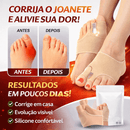 Corretor Ortopédico de Joanetes com Separador de Silicone + 12 PROTETORES DE DEDO EM SILICONE BÔNUS