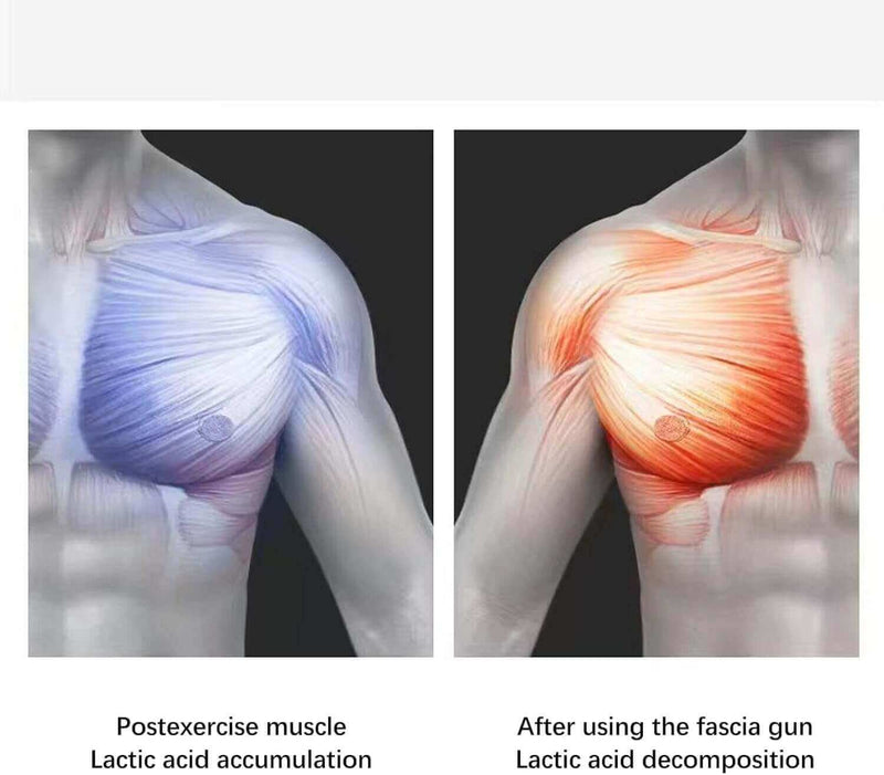 MassageTurbo Elite G3PRO – Alívio Imediato com Vibrações Profundas,Terapia Percussiva de Alta Performance com Potência Profissional