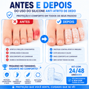 Protetores de Dedos em Silicone – Kit com 24/48 Unidades