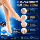Ortho Vital – Dispositivo a Laser para Micose de Unha