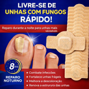 Adesivos Antifúngicos para Unhas – Tratamento Noturno Profundo