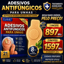 Adesivos Antifúngicos para Unhas – Tratamento Noturno Profundo