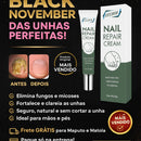 Creme Antifúngico para Unhas Eelhoe – Restaura e Fortalece - Brilho Shop