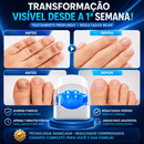Ortho Vital – Dispositivo a Laser para Micose de Unha
