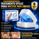 Ortho Vital – Dispositivo a Laser para Micose de Unha