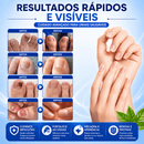 Adesivos Antifúngicos para Unhas – Tratamento Noturno Profundo