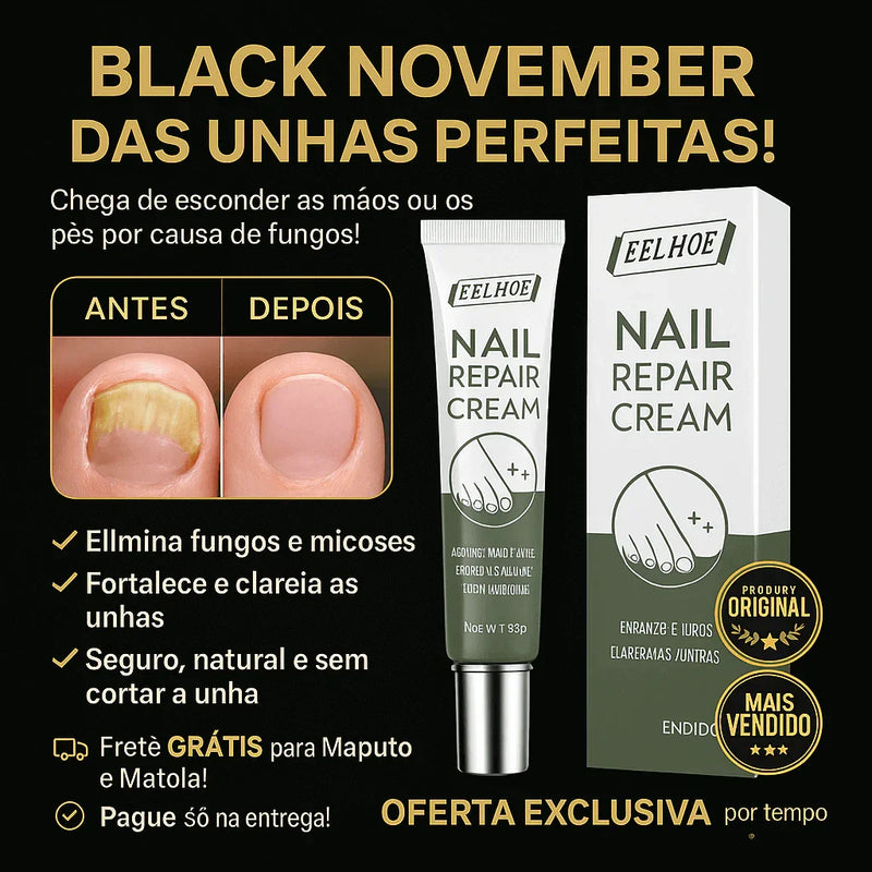 Creme Antifúngico para Unhas Eelhoe – Restaura e Fortalece - Brilho Shop